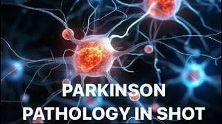 Ease your concept of Parkinsonism 💁🏻‍♀️ by Priya Sharma [upl. by Evers]