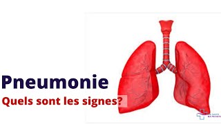 PNEUMONIE QUELS SONT LES SYMPTÔMES D´ALERTE [upl. by Atilegna]