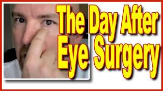 Surviving Eye Surgery  The Day After Chalazion Part 2 [upl. by Retxed107]