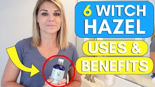 6 Surprising Witch Hazel Benefits amp Uses [upl. by Steffy926]