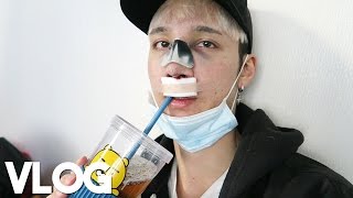 Getting Rhinoplasty in Gangnam  Vlog  Edward Avila [upl. by Laersi]