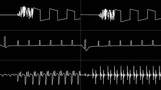 Laxity amp Glenn Rune Gallefoss  “The Other Day” Stereo Mix C64 6581 amp 8580 SID Oscilloscope View [upl. by Muhammad]