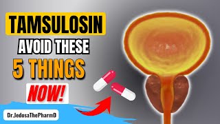 Taking Tamsulosin 5 Things You Must Avoid If You Are Taking Tamsulosin [upl. by Ial]