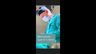 Blefaroplastia superior e inferior  Dr Rafael Rezende [upl. by Durtschi]