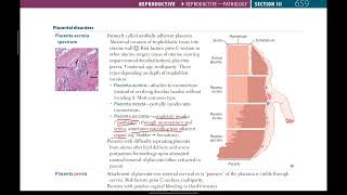 Placental complications  Reproductive  10  First Aid USMLE in UrduHindi [upl. by Artemis]