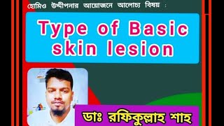 Type of Basic Skin Lesion  ত্বকের ক্ষতের বিকৃতির প্রাথমিক প্রকারভেদ  Dr Rafik Ullah Shah  HU [upl. by Carl207]