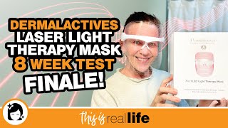 Dermalactives Laser Light Therapy Mask 8 Week Test FINALE  THIS IS REAL LIFE [upl. by Anitsirhcairam]