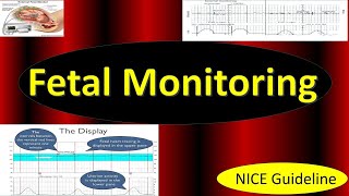 Fetal Monitoring in Labor NICE Guideline 2022  Updates in Cardiotocography CTG [upl. by Patrick]