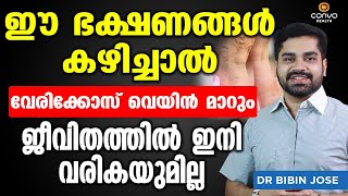 ഈ ഭക്ഷണങ്ങൾ കഴിച്ചു വെരികോസ് വെയ്ൻ പൂർണമായി മാറ്റം Vericose Treatment in Malayalam Dr Bibin Jose [upl. by Nolra]