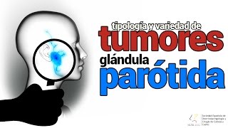 Tumores en la glándula parótida cáncer de glándulas salivales  SEORL CCC [upl. by Sane]