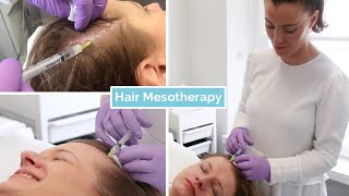 Hair Loss Mesotherapy  The Laser and Skin Clinic [upl. by Llenyar]