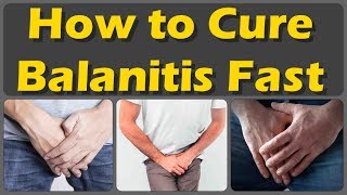 How To Cure Balanitis With Oils Fast And Causes Symptoms And Treatment Of Balanitis [upl. by Aelat167]