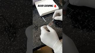 Blood grouping🩸medlife medico medicalstudent bloodgroup nursing shorts love bloodgrouptest [upl. by Nibaj]