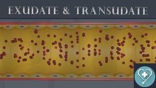 Exudate and Transudate  Introduction  Pathology [upl. by Adnarim]