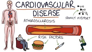 Understanding Cardiovascular Disease Visual Explanation for Students [upl. by Tem235]