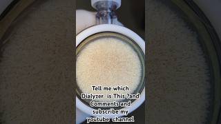 A dialyzer is a medical device used in hemodialysis to filter waste excess fluids and toxins [upl. by Eniamahs]