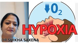 Hypoxic Classification of Hypoxia Telegram httpstmedrshikhasaxenahumanphysiology [upl. by Eldoria]