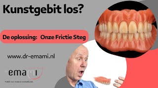 implantaat klikgebit kunstgebit frictie steg prothese [upl. by Anigar49]