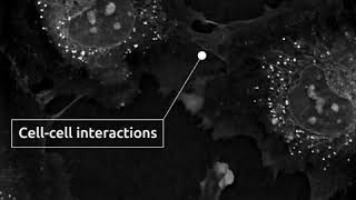 Cells in Action membrane protrusions in HUVECs Human Umbilical Vein Endothelial Cells [upl. by Chelsae]