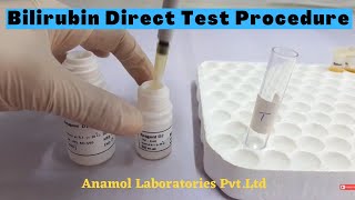 Bilirubin Test Procedure  Bilirubin Direct Test ProcedureIn English [upl. by Eyar]