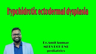 Hypohidrotic ectodermal dysplasia [upl. by Anod923]