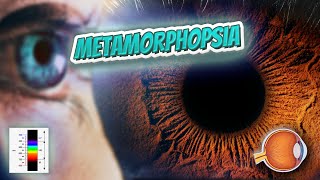 Metamorphopsia  Your EYEBALLS  EYNTK 👁️👁️💉😳💊🔊💯✅ [upl. by Tippets]