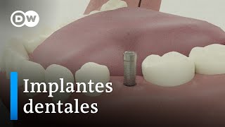 Implantes dentales ventajas e inconvenientes [upl. by Rana]