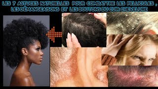 7 ASTUCES NATURELLES POUR COMBATTRE LES PELLICULES ET LES DEMANGEAISONS DU CUIR CHEVELURE [upl. by Attelrahc72]