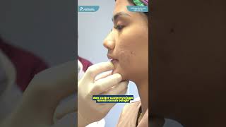 WAJAH V SHAPE DENGAN 1 X TREATMENT FILLER DAGU [upl. by Okihsoy]