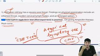 INFECTIOUS MONONUCLEOSIS  PSEUDOMEMBRANE  CASE STUDY [upl. by Fari319]