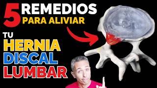 5 REMEDIOS CASEROS para ALIVIAR una HERNIA DISCAL LUMBAR [upl. by Fiann]