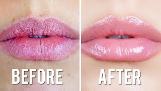 CHAPPED LIPS REMEDY [upl. by Reiniar]