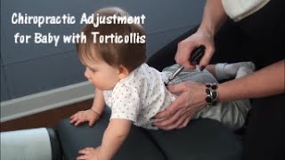 Chiropractic Adjustment for Baby with Torticollis [upl. by Gnehp]