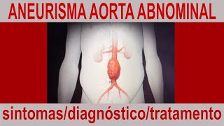 ANEURISMA NA AORTA ABDMINAL [upl. by Adian50]