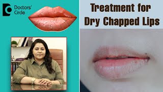 Heal Chapped Lips Fast with these 4 Simple Remedies  Dr Tina Ramachander  Doctors Circle [upl. by Leryt]