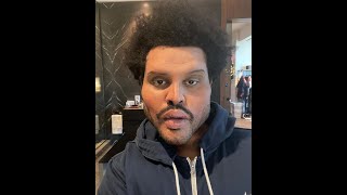 La verdad detrás del extraño aspecto del rostro de The Weeknd [upl. by Ahsets]