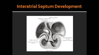 Interatrial Septum Development [upl. by Atilef]