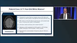 Implementing Synergistic Multimodal Approaches With Tumor Treating Fields [upl. by Epp]