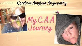 Do I have the signs of Vascular Dementia My CAA Journey Cerebral Amyloid Angiopathy [upl. by Lehet95]