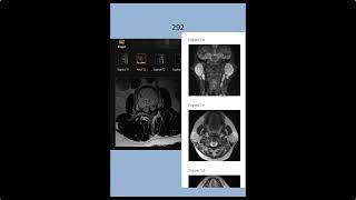 RADIOLOGY EXAM CASES [upl. by Yttocs]