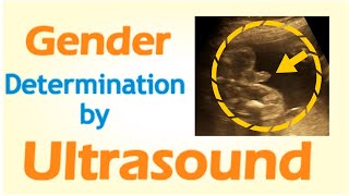 Gender Determination by Ultrasound [upl. by Halyk]