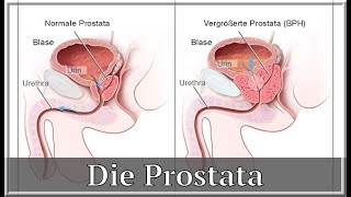 Ab 40 sollte die Prostata untersucht werden [upl. by Bartholomew]