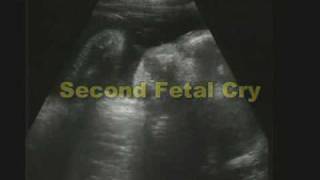 Discovery Channel Video Baby Cries in Wombswf [upl. by Dianne]