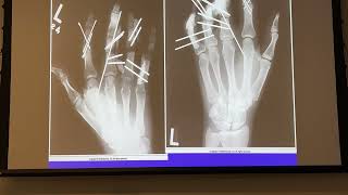 Radiographic Image Critique Upper Extremity Part 1 fingers through elbow 2024 [upl. by Weinhardt]