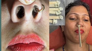 Nose hair waxingpiggynose nosepulling pummybeautyparlour pummybeautyworld [upl. by Idnahk379]