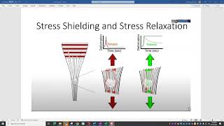 Remodeling Tendons amp Tendinopathy Through Isometric Exercises Tendon Loading amp Remodeling [upl. by Ahouh]