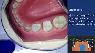 Conventional crown preparation for PMC  Institute of Dentistry QMUL [upl. by Bobbi]