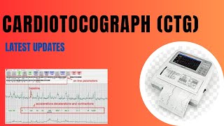 Cardiotocograph CTG Latest Updates [upl. by Nivrehs]