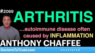 ANTHONY CHAFFEE a1  ARTHRITIS …autoimmune disease often caused by INFLAMMATION [upl. by Morrissey]