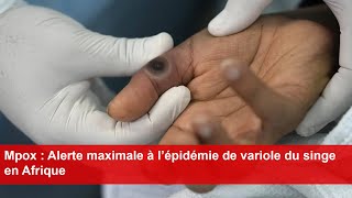 Mpox  Alerte maximale à l’épidémie de variole du singe en Afrique [upl. by Ednutabab]